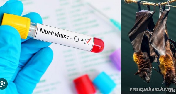Introducing Nipah Virus